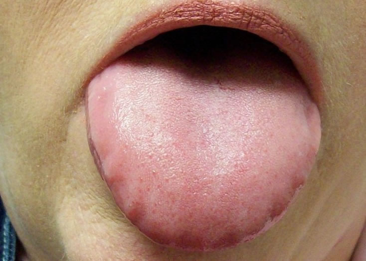 Ú̦���˻ᵼ�¿ڳ�������������¿�ǻ�����ʺ�������ȩ��