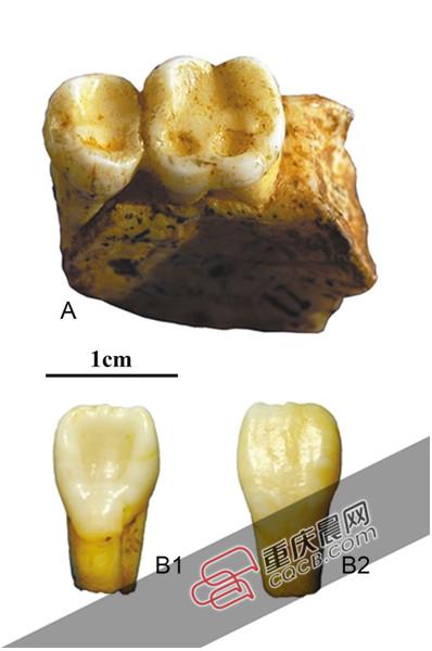 巫山人牙齿化石