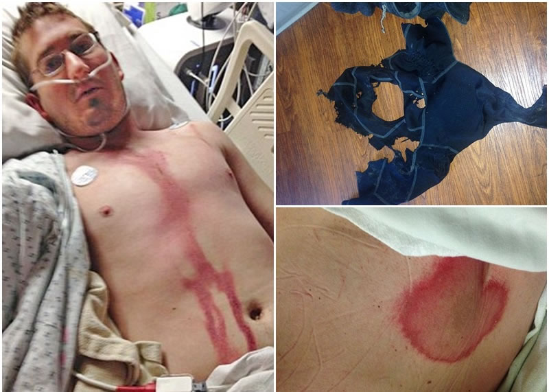 ����˹����ͼ������������ͷ���������³�����Ѫ�ۡ�