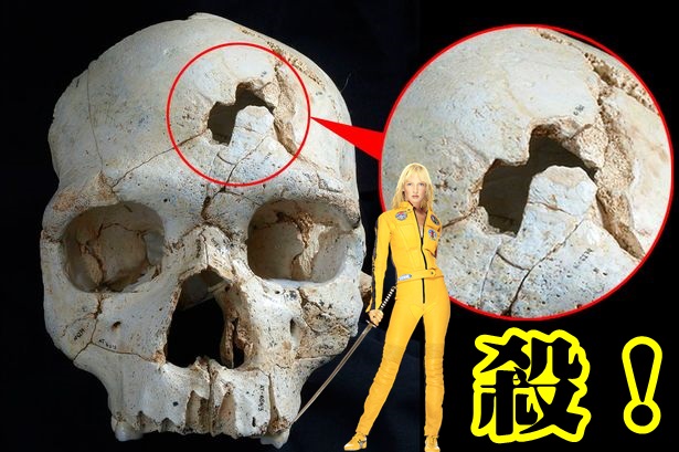 头骨上有两个类似弹洞,相信死者死于袭击。