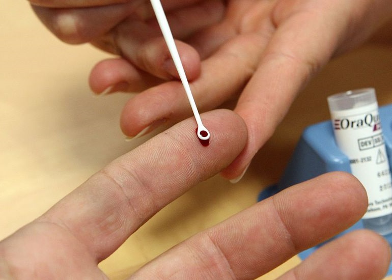 ����ҽѧ�¼��鷨VirScan��һ��Ѫ�����ȥ���ڲ���