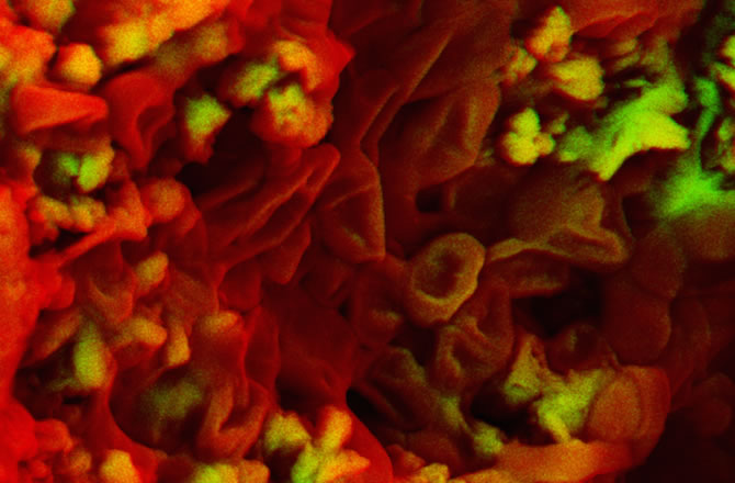 7500万年前白垩纪恐龙骨头化石中发现类似红细胞的结构和类似胶原蛋白的纤维