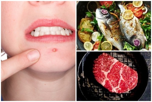 常见于肉类、鱼、鸡蛋及奶类制品中的一种维他命B,可能是导致爆疮的元凶。