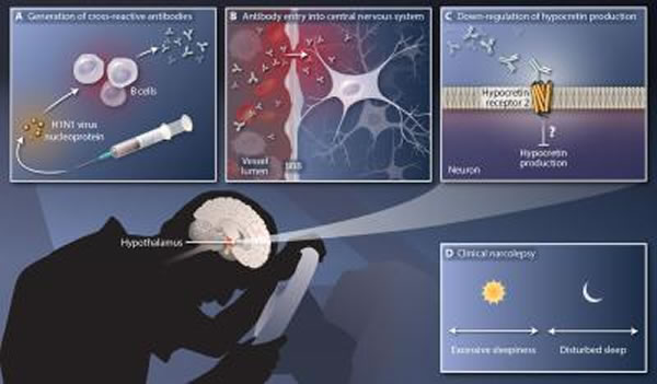 本图显示因流感病毒核蛋白而触发的抗体如何与调控睡眠(下视丘分泌素受体2)的脑蛋白受体发生交叉反应并导致发作性嗜睡病。[鸣谢:S. Sohail Ahmed 和