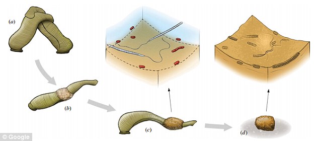 �ڳ�ȡ�˻�ʯ���о���Աʹ���˹��ɨ�������΢�����Լ����ڷ����X���߲�����������������������ٶ������Һ����ʽ���ڼ룬���������һ�㵰�������ʡ����Ŵ���ͬ���