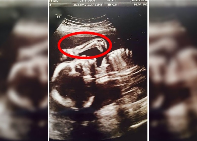 大家看到雷龙在哪吗?就在宝宝的头上(红圈示)。