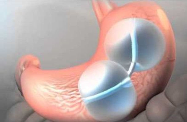 θ�������챥�Ǹо����Ӷ��ﵽ����Ч����