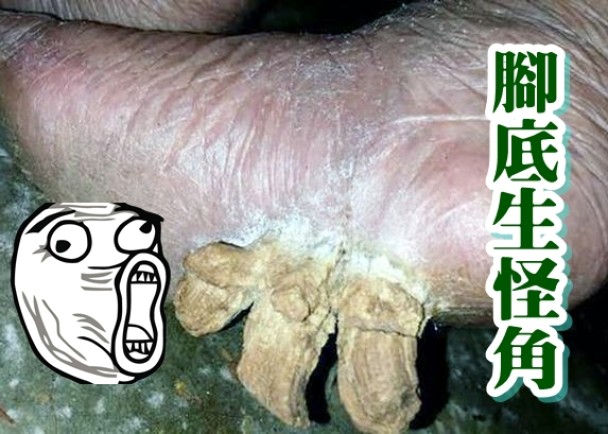 �������˽ŵ׳����Ĺֽǣ����μ�Ϊ���ˡ�