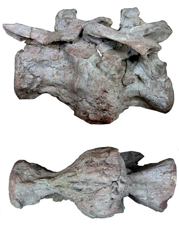 两个明显融合的病变椎体