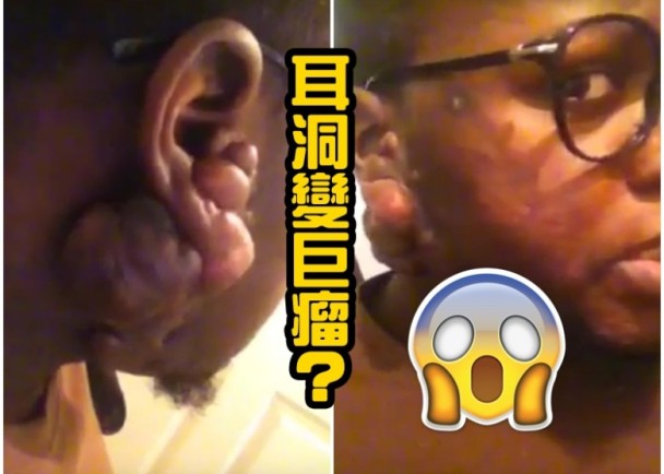 �������Ӵ�������������ֲ�����