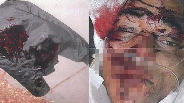 ���൱ʱ����Ա���ͷ��Ѫ��