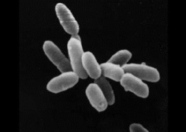 日本研究员首次证实,古细菌(图)可以感染人类令人类发病。