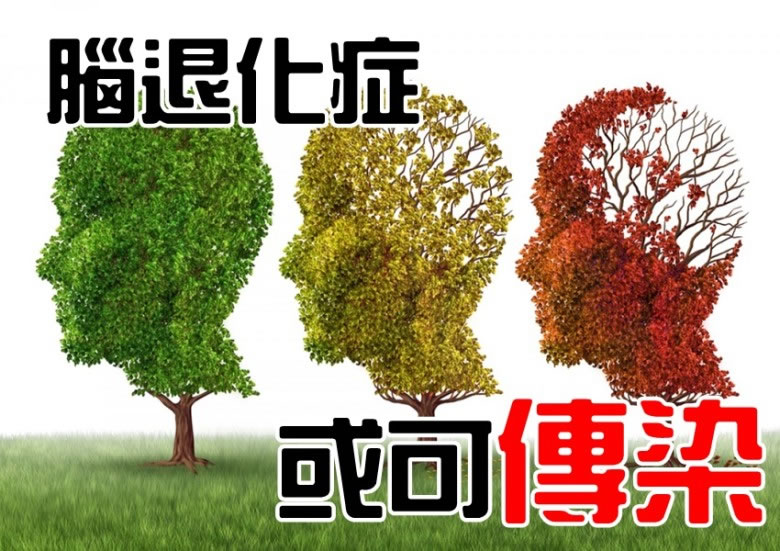 ���˻�֢���п���͸��ҽ�Ƴ����ҽ���þߣ���Ⱦ�������ˡ�