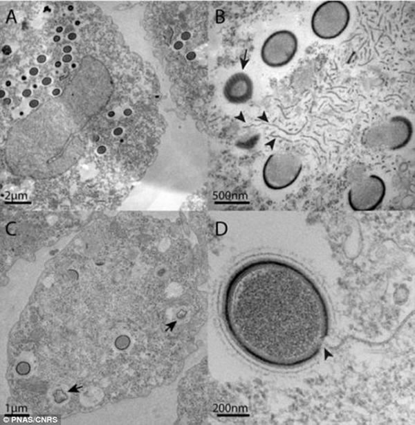 正在感染棘变形虫的Mollivirus sibericum。这种巨型病毒长0.6微米,在光学显微镜下就可以看到