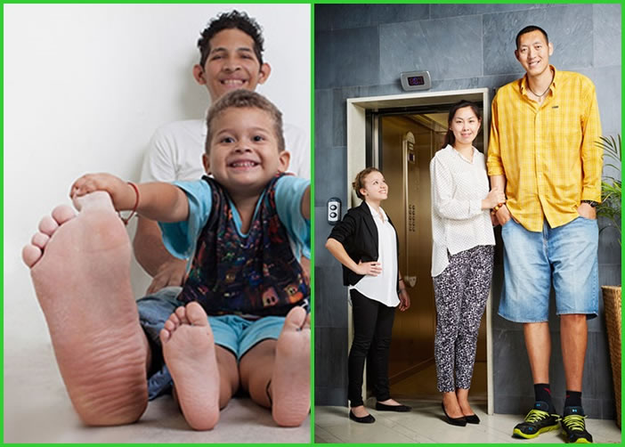 埃尔南德斯拥有最大脚掌(左图)。孙明明与妻子徐艳,为全球最高的伴侣(右图)。