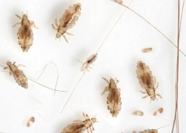 ͷƤͷǷ࣬׳ͷʭͼ´