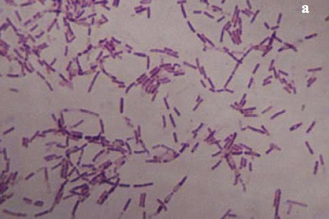 ѧΪǽС͹Ӭʵ飬۲쵽һϵеĳԻӰ죬ڳٺ棬żǿı