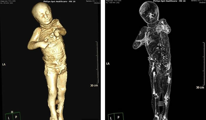 考古学家们利用过去一年的时间,在仔细修复和扫描了86具在庞贝古城中发现的遇难者遗体后公布了首批扫描结果。