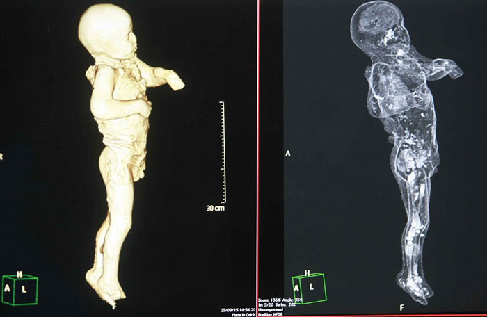 左图扫描画面很像医生为孕妇进行的3D扫描,小男孩双唇紧闭,好像处于惊恐状态。