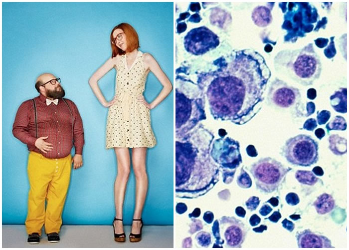 �о���ʾ���Ӹ��뻼��֢���սϸ��й�