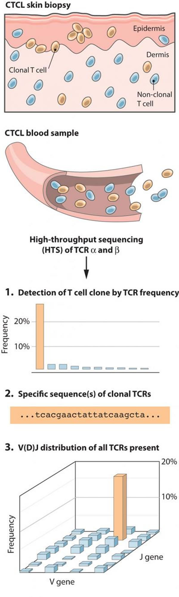 对重新排列的T细胞受体(TCR)基因进行高通量测序为皮肤T细胞淋巴瘤中的T细胞群提供了前所未有的信息。在获取皮肤活检或外周血样本之后,被提取的基因组DNA被PC