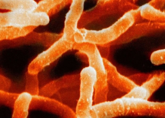 其中一种为“放线菌”(图),常见于人类皮肤表面。