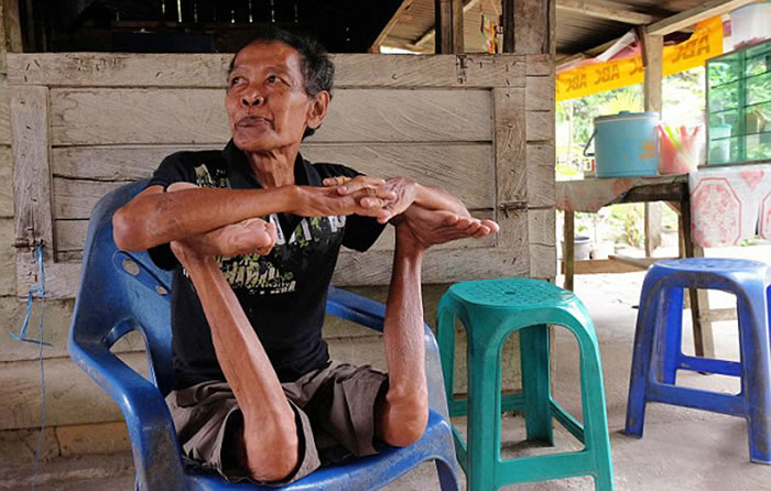 贝扬老人身体健康,并未有任何异常。