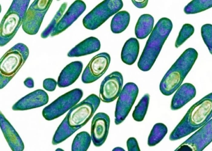 显微镜下的高抗药性病毒。