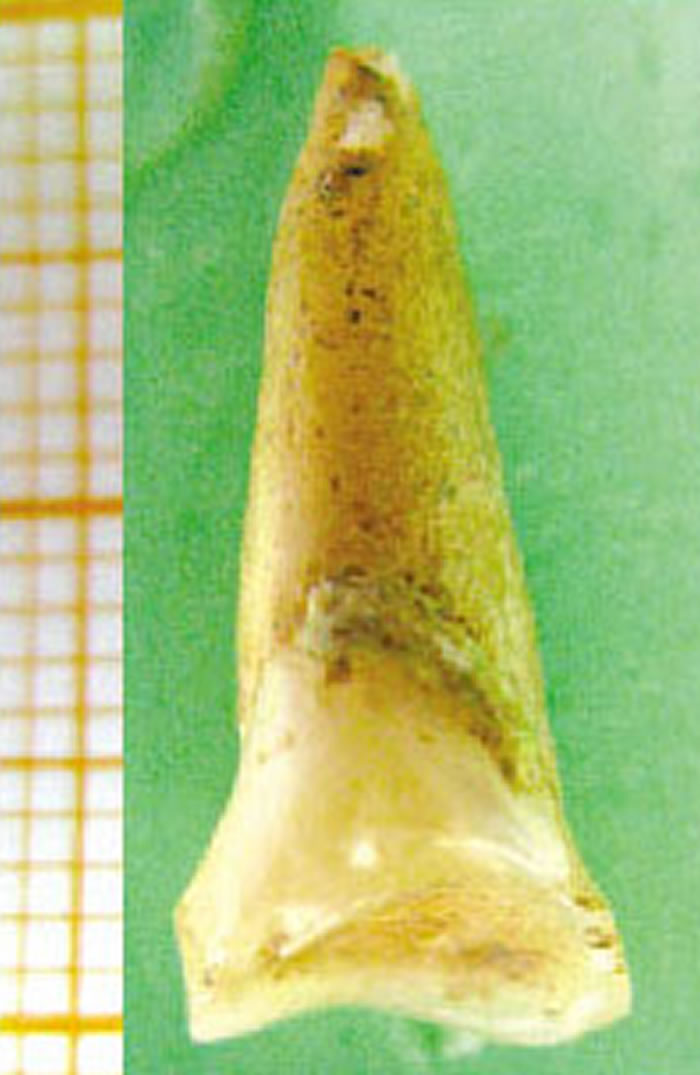 福岩洞出土的具有完全现代人特征的人牙化石