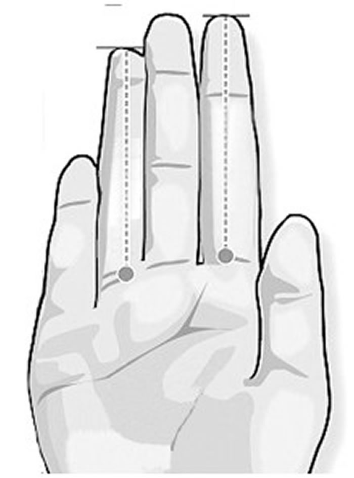 韩国科研机构的最新研究结果显示,食指和无名指长度差距悬殊的女性,生女儿的概率更高。