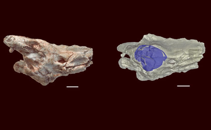 CTɨ����������ߵ��ڶ��ṹ�ǳ����أ�����Ѩ�����ж��������