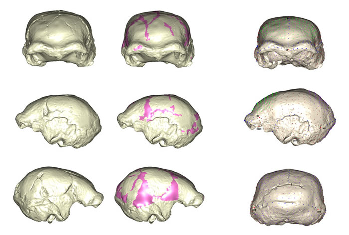 和县直立人脑颅化石表面形态的重建和标志点及半标志点位置