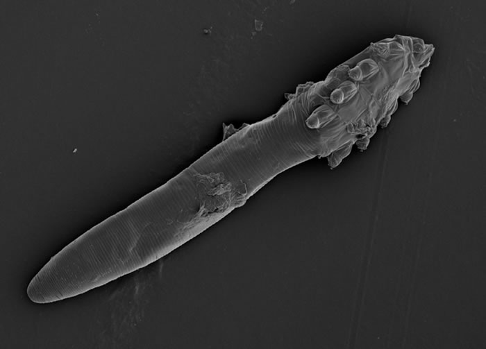 人类毛囊螨虫的遗传结构可能为人类迁移和进化提供线索