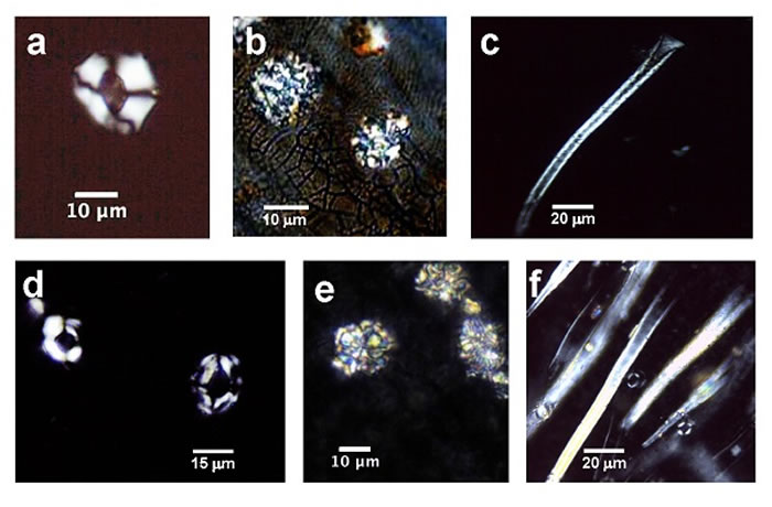 图2 考古植物样品中分析出的植钙体类型组合(a,b,c)与现代茶叶植钙体(d,e,f)类型组合对比