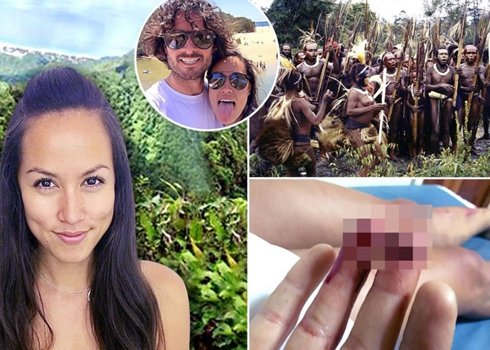 ������µ��Ͳ����¼�����ɭ�����б�����ʳ����°��