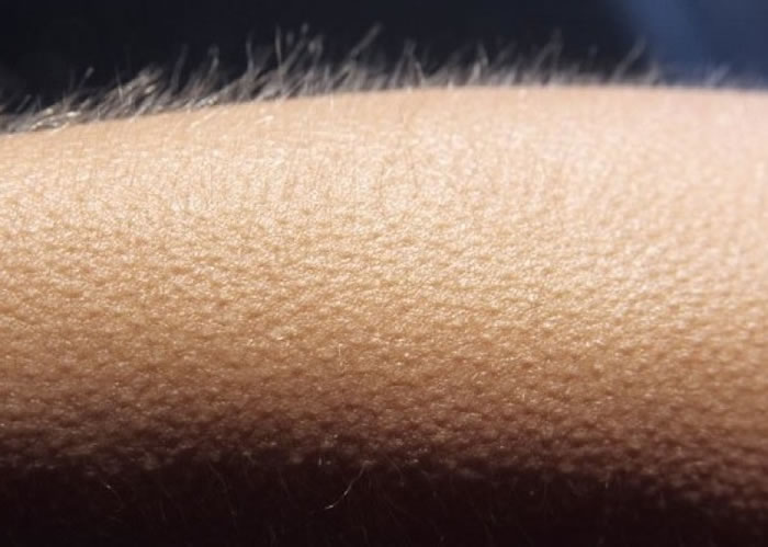 ��������͸��������Ƥ�����˵���