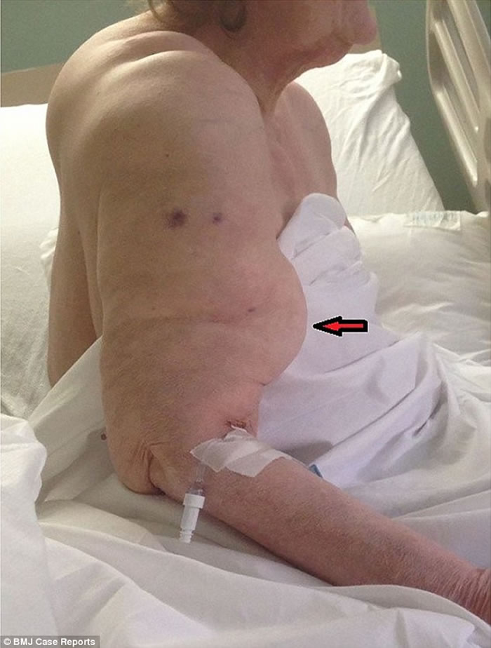 病人同意停止饮酒,但不愿意接受手术。