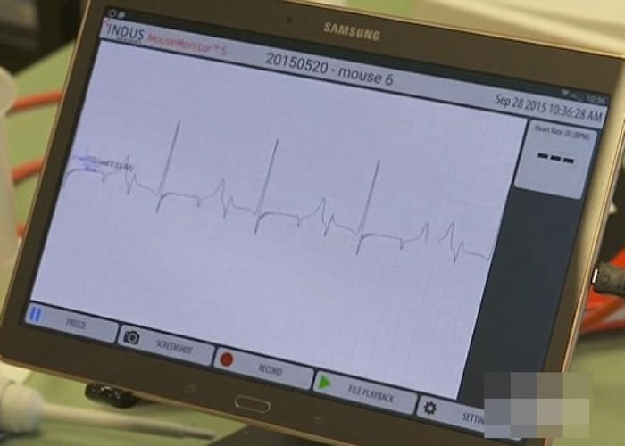 机器显示蟾蜍在注射毒液前心跳率正常