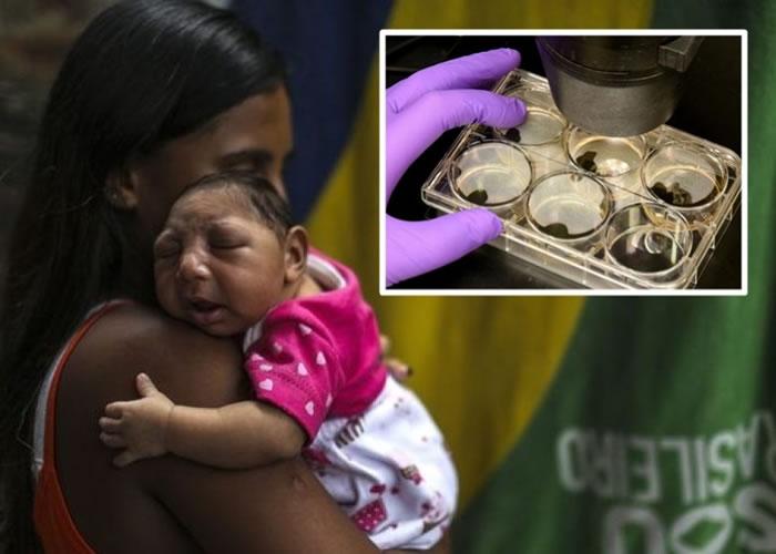 ��ѧ�ҽ������ڳɹ��ҵ�կ��������Сͷ֢֮���������ϵ��