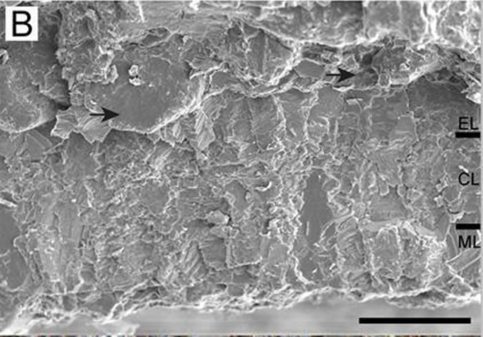 ML为乳突层、CL为连续层、EL为外部层