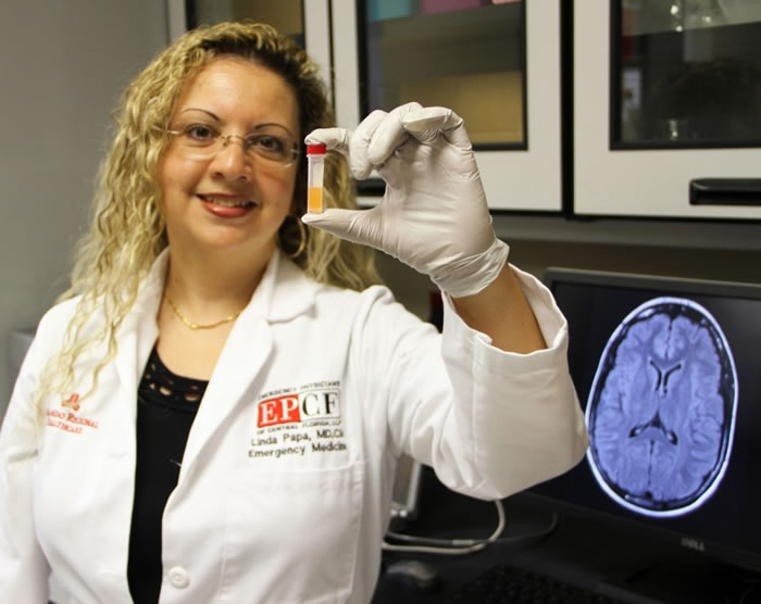 美国最新研究发现透过简单的验血可以检测到病人有否出现脑震荡