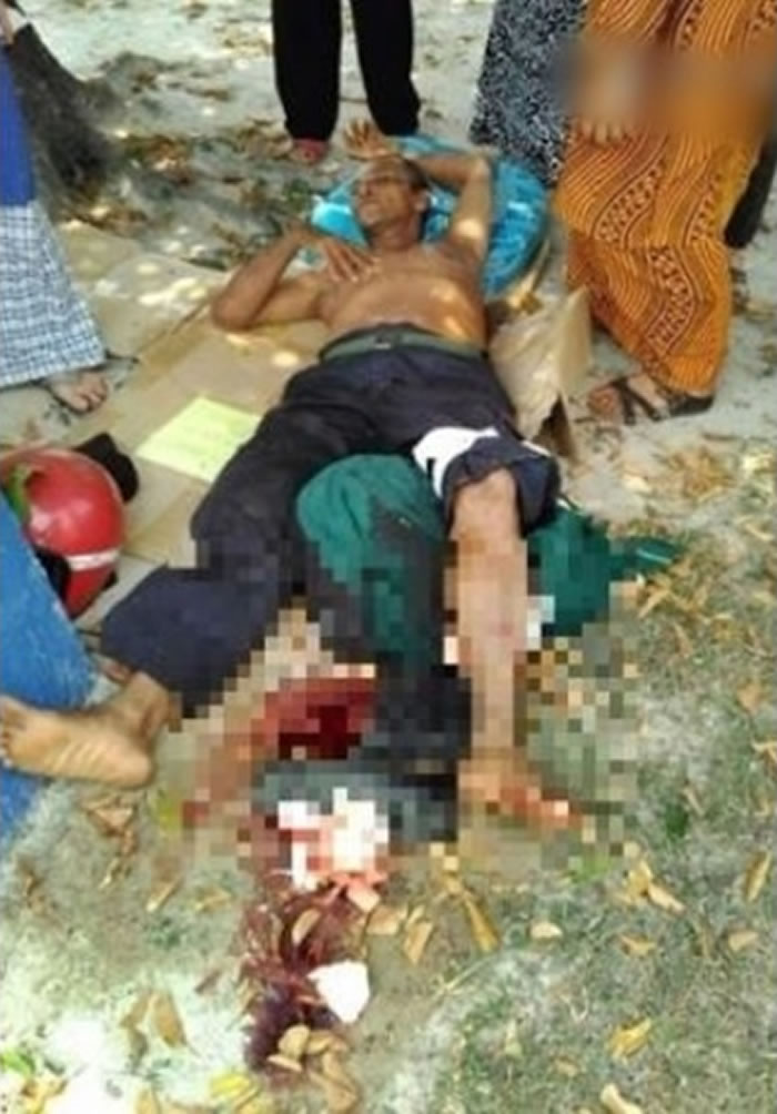 ɭ�ֲɼ����������Ϯ�� �����������ӻӵ����˱���