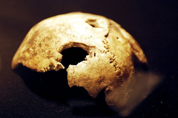 死去活来:科学家要复制王子、蓝侬、希特勒