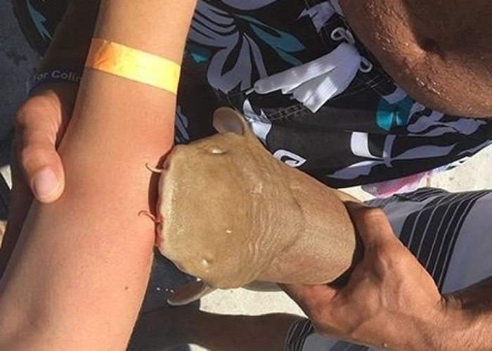 美国佛州女泳客被小铰口鲨咬住手臂不放 要连带鲨鱼一起送医院治疗