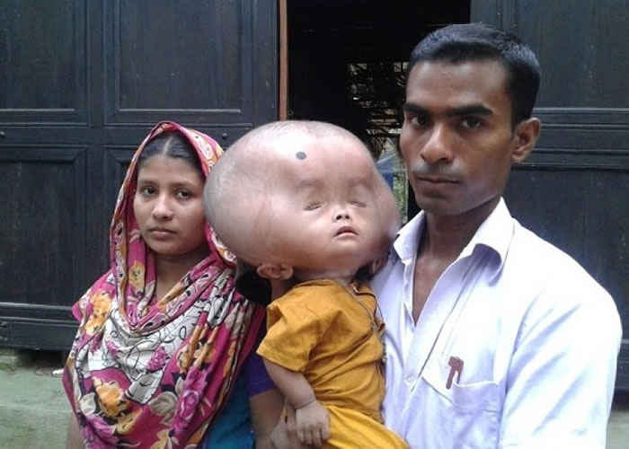 埃蒙父母表示无力送儿子出国就医。