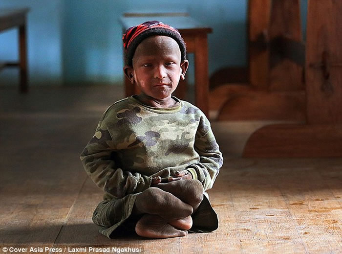 �Ჴ����ͯ������Ѣ ����˵��������ʯͷ��