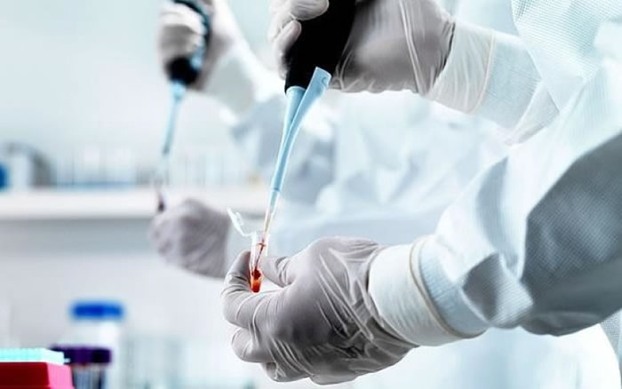 验血检验抗体,可测知一个人是否心脏病高危人士。