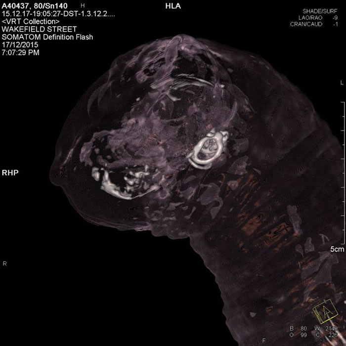 透过原子序成像所输出的南澳洲博物馆藏之猫木乃伊内部影像。 PHOTOGRAPH BY JAMES M. BEWES