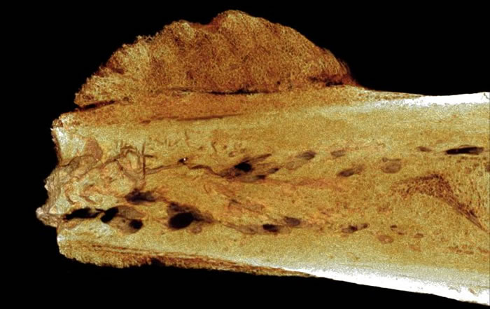 微电脑断层扫描（micro-CT）影像显示，远古人类近亲的趾骨长了肿瘤。 / PHOTOGRAPH BY PATRICK RANDOLPH-QUINNEY, U