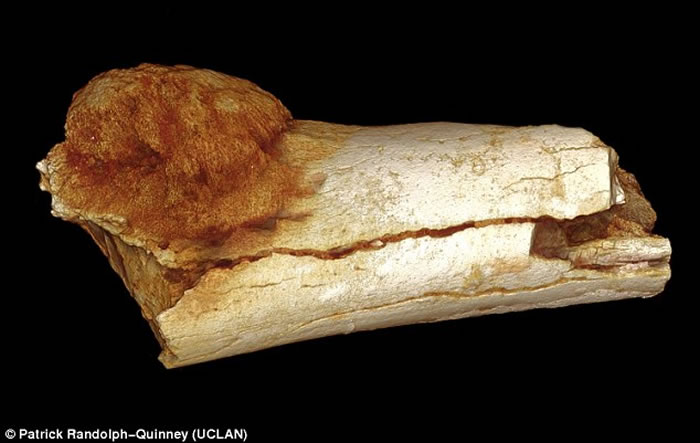 南非出土古人类化石证人类170万年前已患癌症